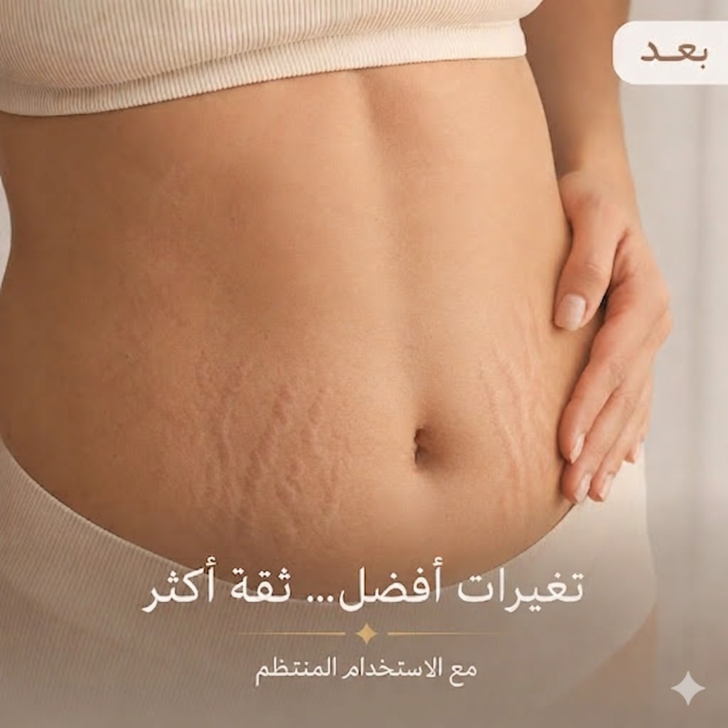 قبل